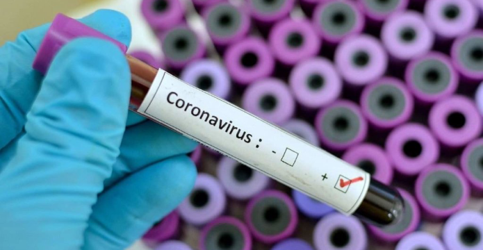 В Узбекистане создали тест-системы по выявлению коронавируса.